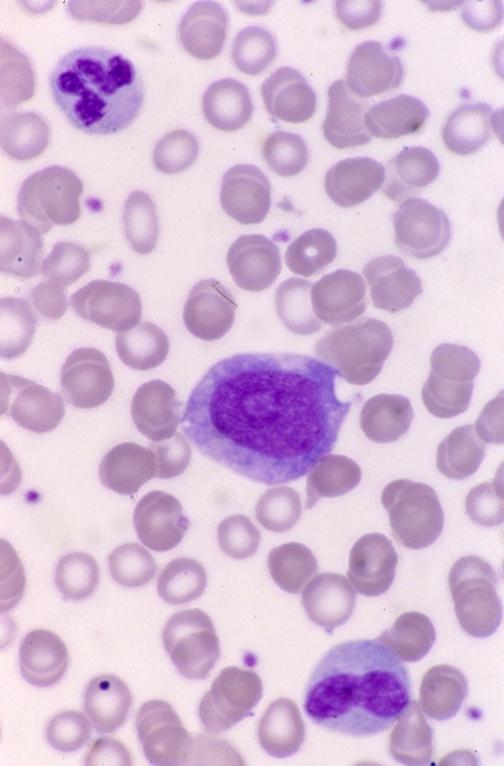 Blood - bone marrow 5