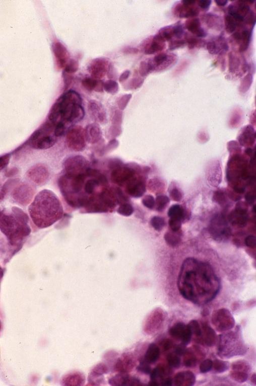 Blood - decalcified bone 2