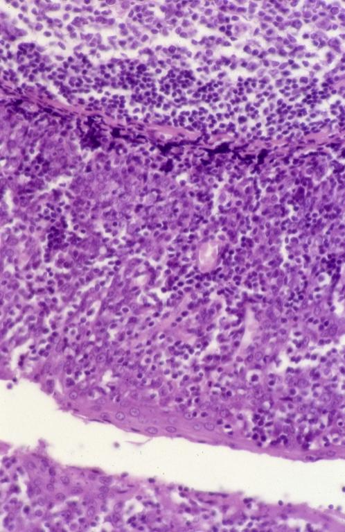 Lymphatics - palatine tonsil 1