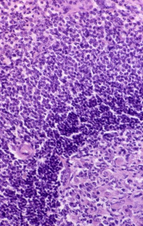 Lymphatics - spleen 2