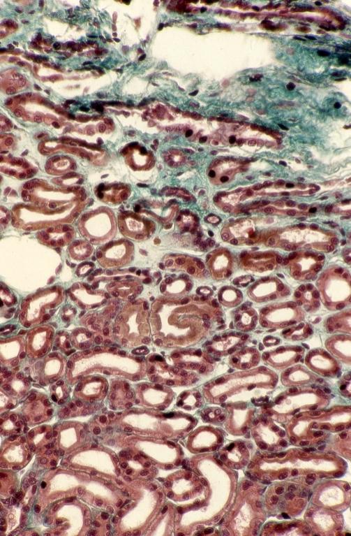 Excretory - amphiuma kidney