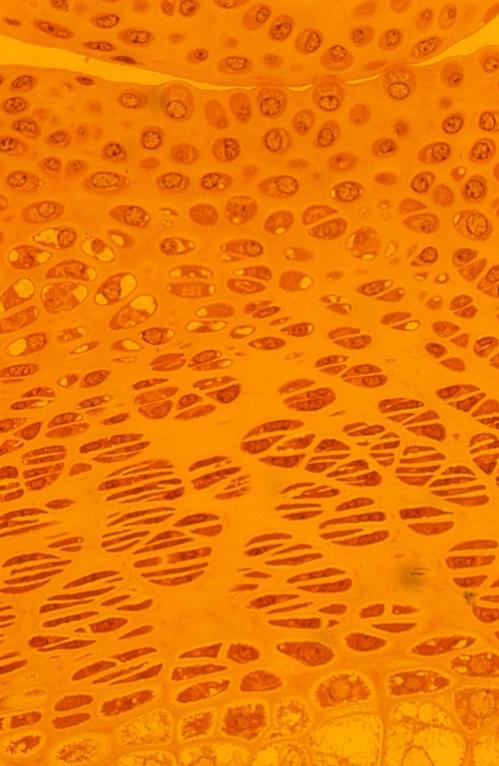 Cartilage - mouse phalange 2