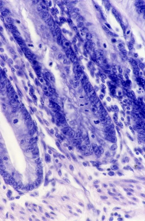 Digestive - ileum 5