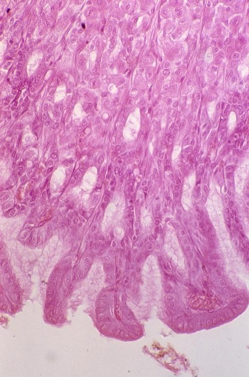 Digestive - stomach 10