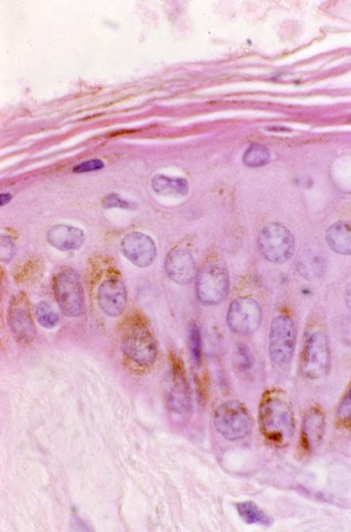 Skin - epidermis with pigment 2