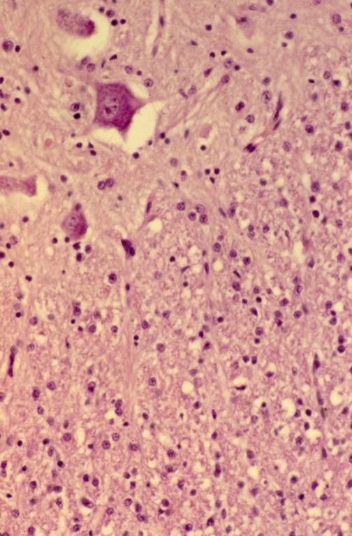 Neural - gray and white matter 1