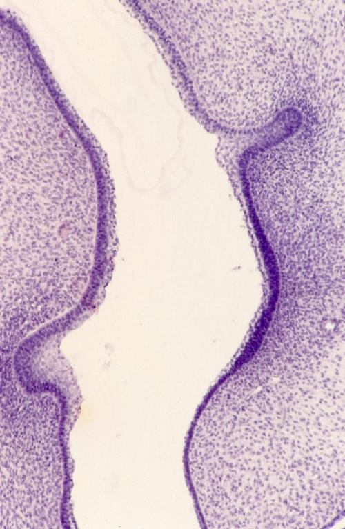 Embryo - pig embryo 2