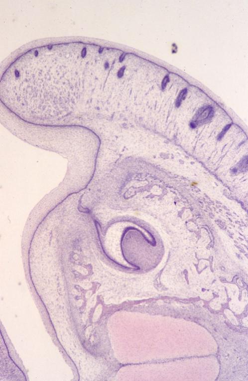 Embryo - pig embryo 7