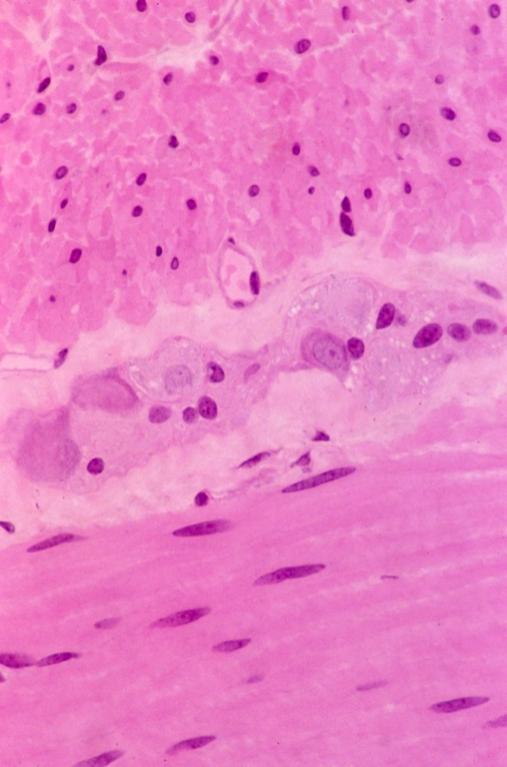 Neural - monkey duodenum